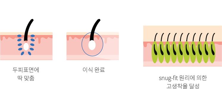 단계